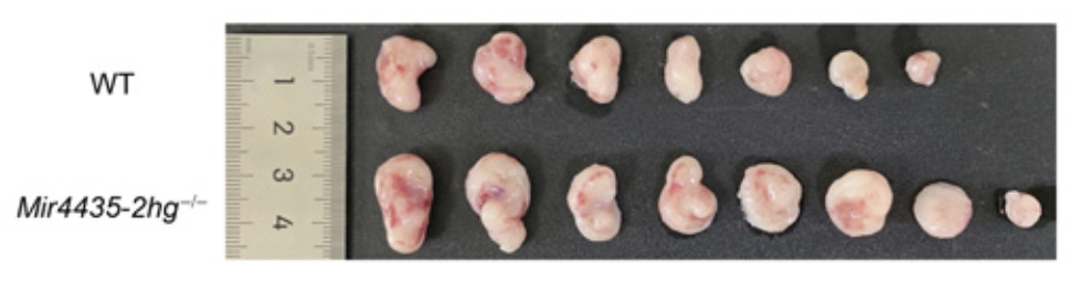 长链非编码RNA “MIR4435-2HG” 通过重编程中性粒细胞抑制结直肠癌的发生和发展