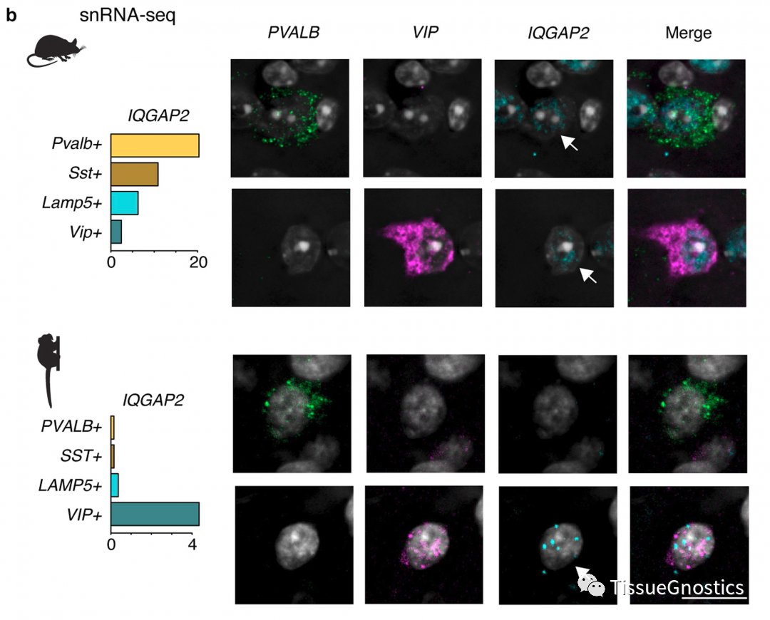 Nature| TissueFAXS Q+助力灵长类动物中间神经元的新发现