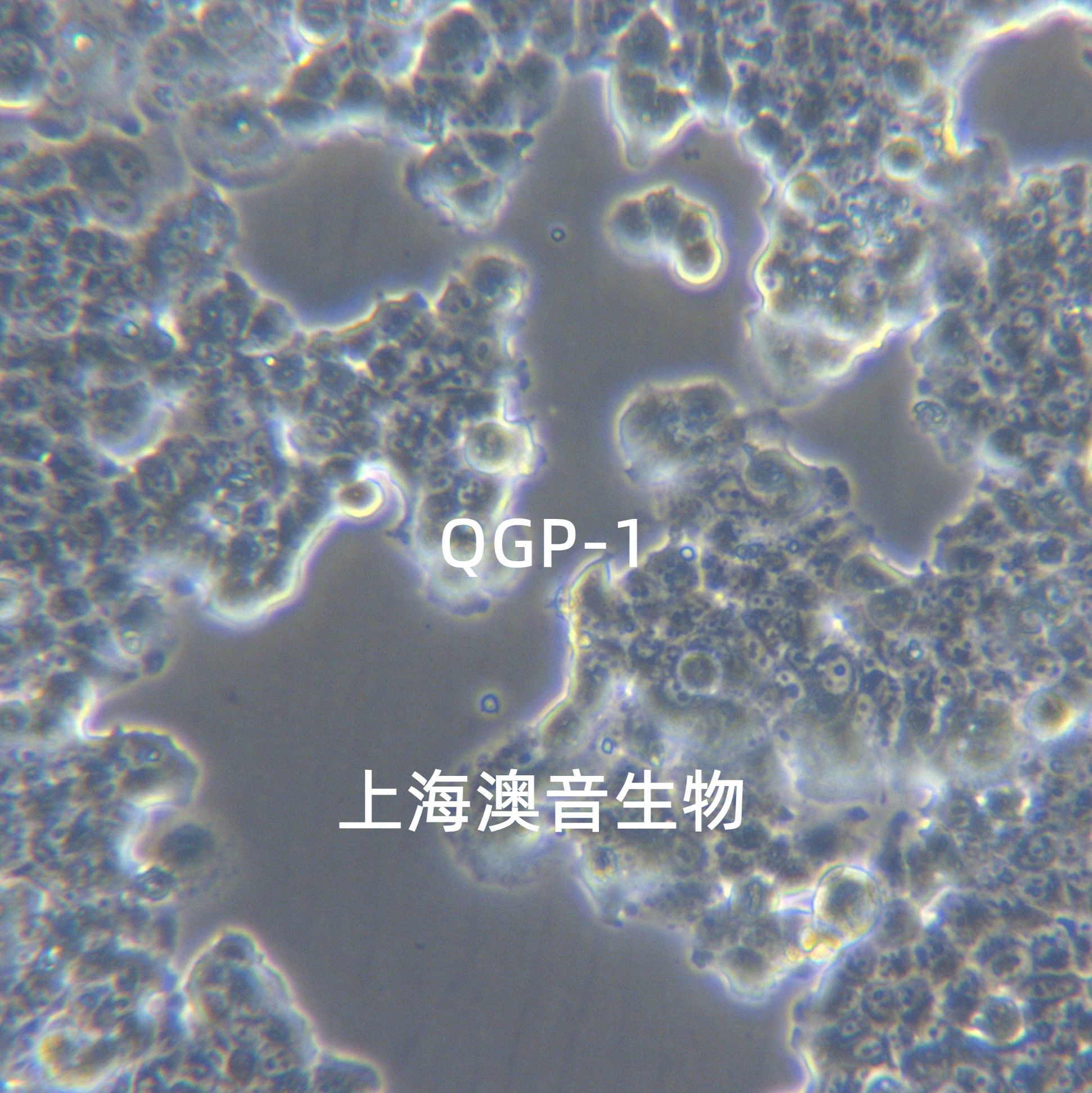 QGP-1[QGP 1; QGP1]人胰腺癌细胞