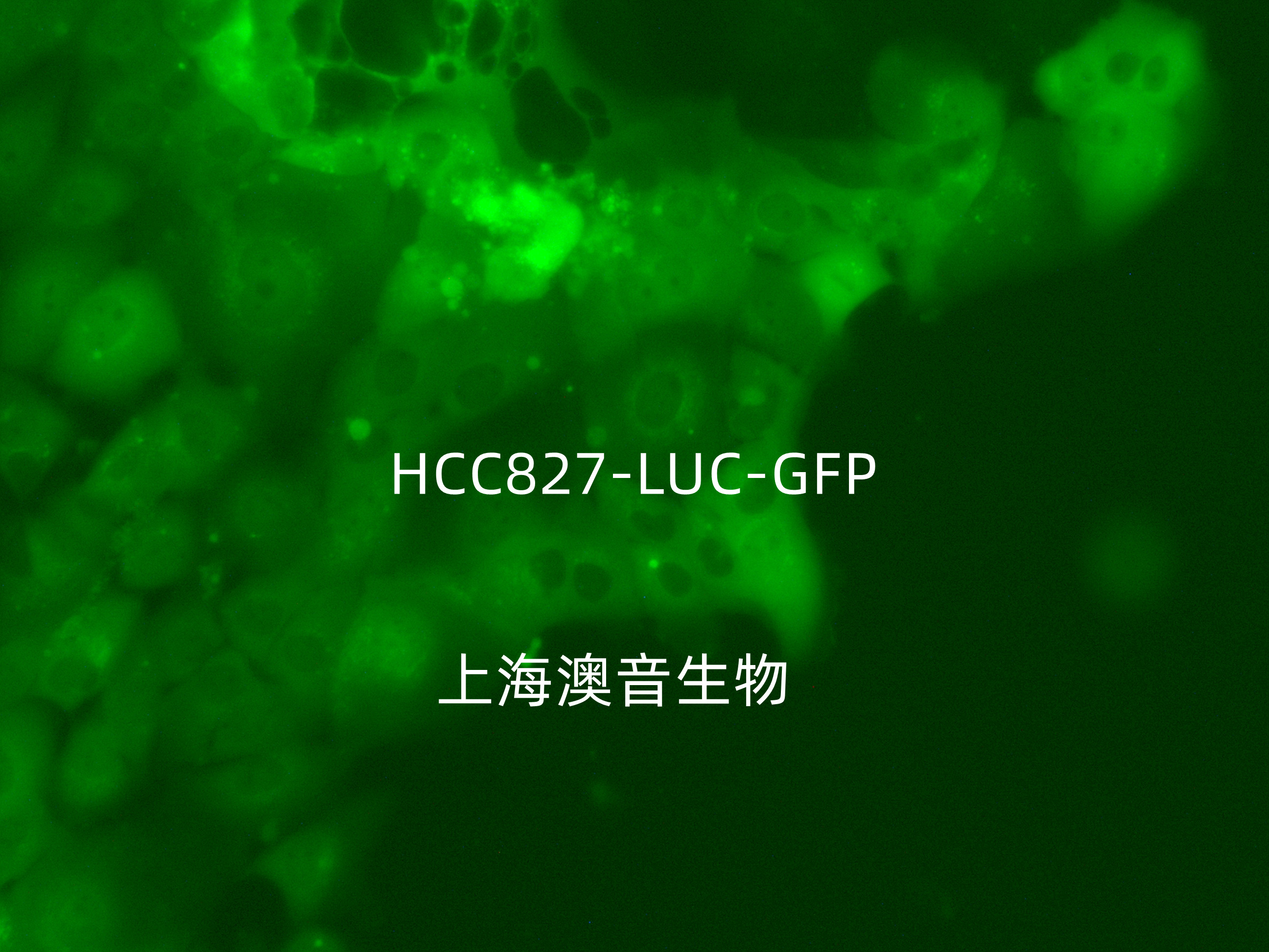HCC827-LUC-GFP-Puro[hcc827-luc