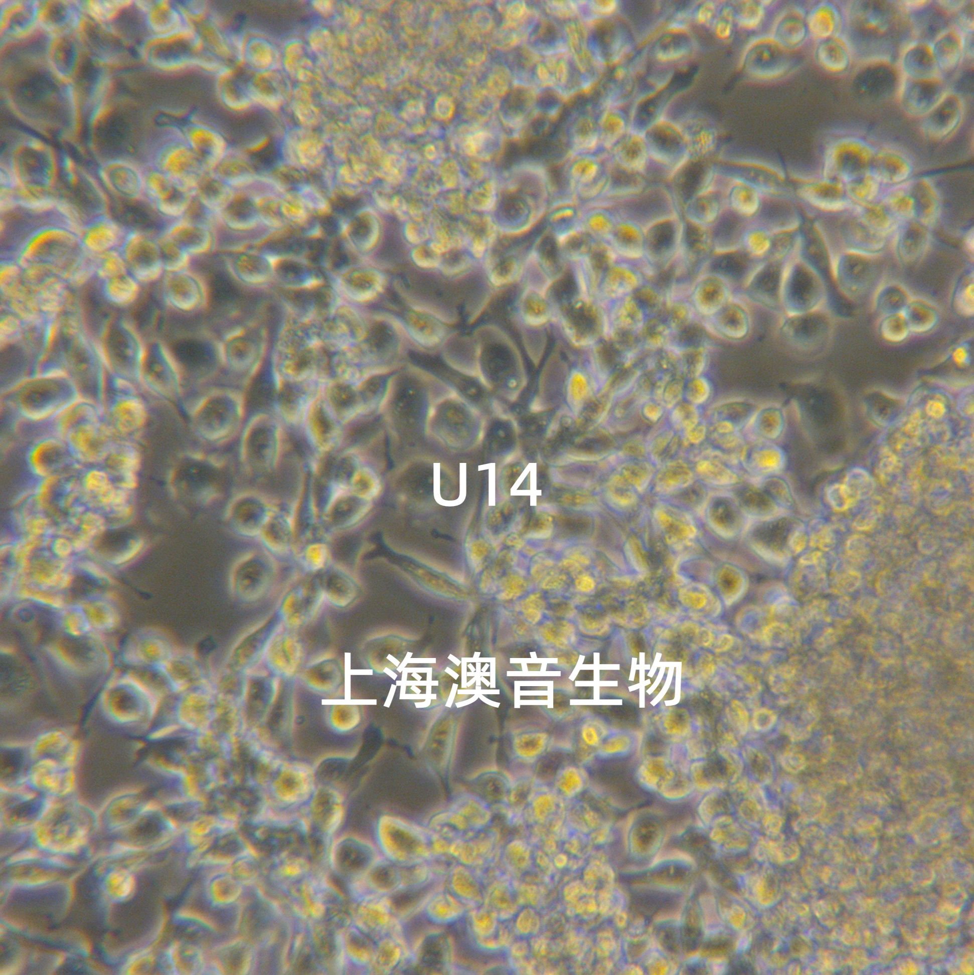 U14[U-14]|U14|U-14小鼠子宫颈癌细胞