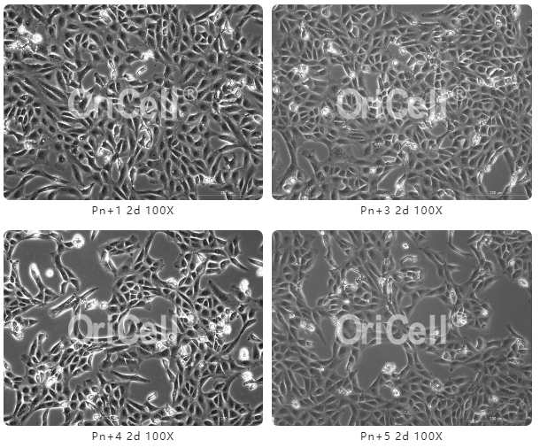 上新|OriCell®新西兰「新生牛血清」，疫苗、诊断试剂生产更理想！