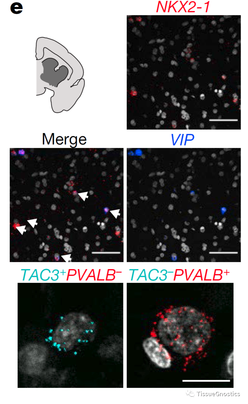 Nature| TissueFAXS Q+助力灵长类动物中间神经元的新发现