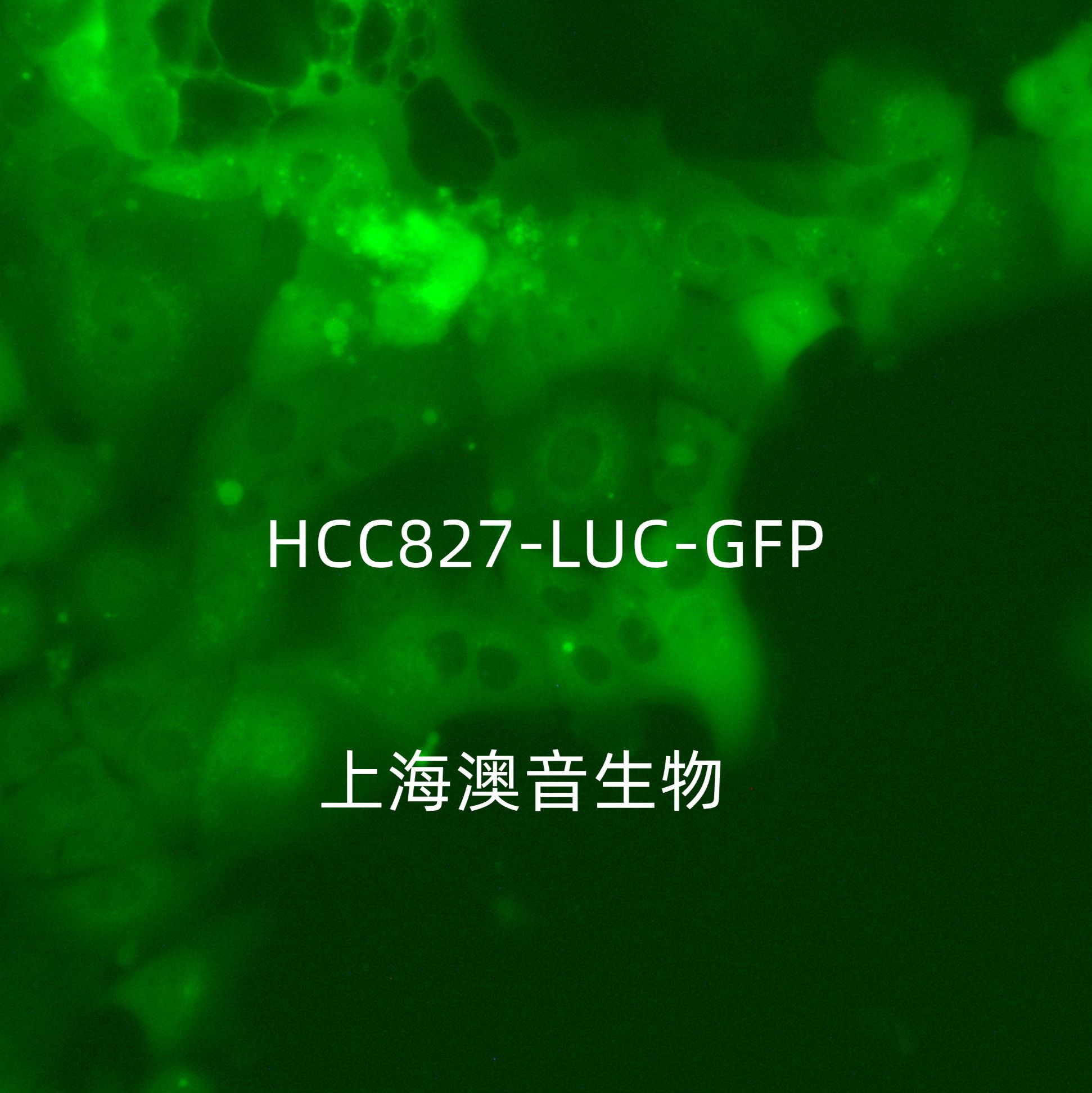 HCC827-LUC-GFP-Puro[hcc827-luc;hcc827-gfp]双标记的人非小细胞肺癌细胞