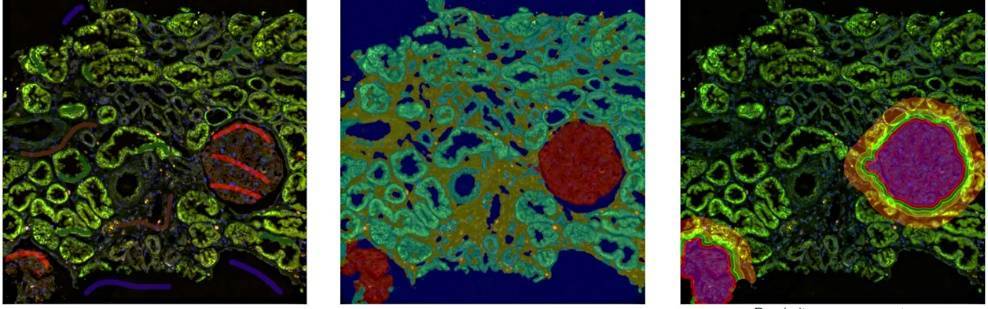 多组学数据标准的验证利器分享——TissueFAXS Cytometry技术