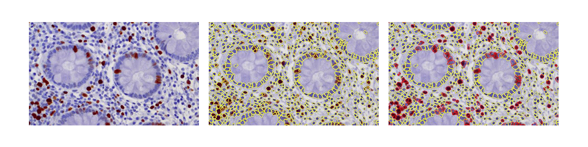 多组学数据标准的验证利器分享——TissueFAXS Cytometry技术