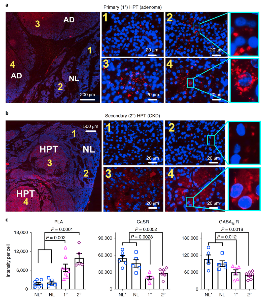 TissueFAXS Cytometry技术为蛋白组学研究提供原位验证新方法