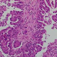 染料法实时RCA试剂盒(双链DNA模板专用)