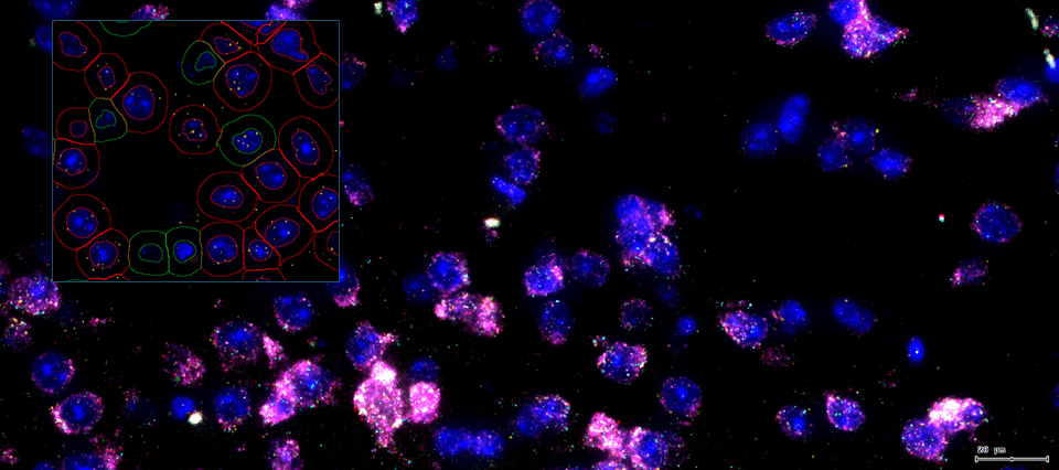 多组学数据标准的验证利器分享——TissueFAXS Cytometry技术