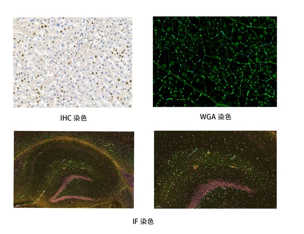 组织切片取材注意事项