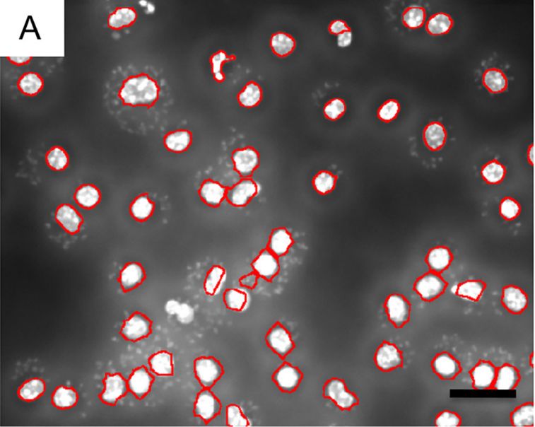 StrataQuest新型定量分析方法：探索胞内原生生物与宿主细胞的关系