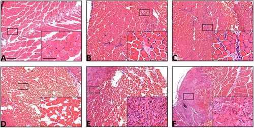 法医病理学：利用TissueFAXS系统精准识别大鼠挫伤性骨骼肌再生过程中性粒细胞
