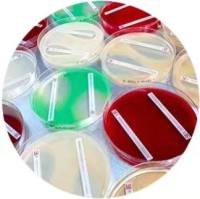 人卵巢腺癌细胞;OVCAR-3