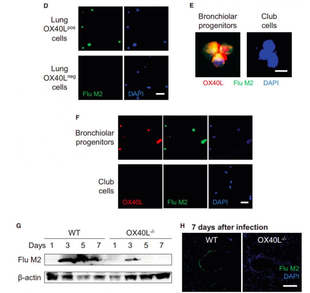 日本东北大学医学研究所| 流行性感冒和肺炎的分子机制