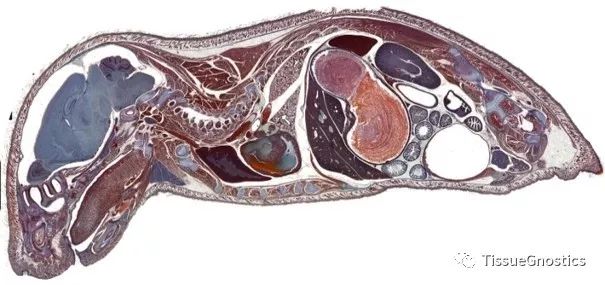 如何获得精准客观的组织学定量分析数据？——TissueFAXS Cytometry技术