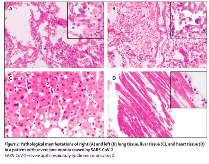 TissueFAXS Cytometry技术在新冠肺炎相关研究领域中的应用