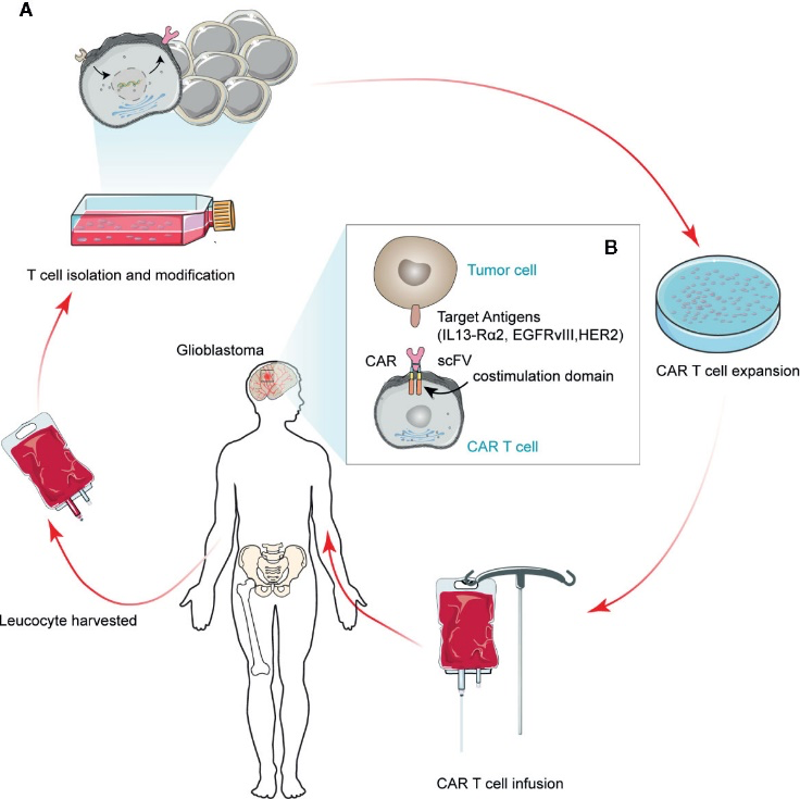 CAR-T细胞产品的免疫表型影响临床疗效，EGFRvIII 特异性 CAR-T细胞的PD-1表达可预测复发性脑胶质瘤的治疗效果