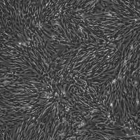 人牙髓间充质干细胞