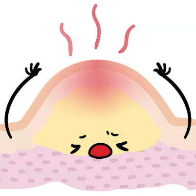 胜“痘”士科学操作指南