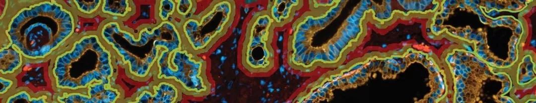 从用户视角看“大数据原位空间定量分析技术”