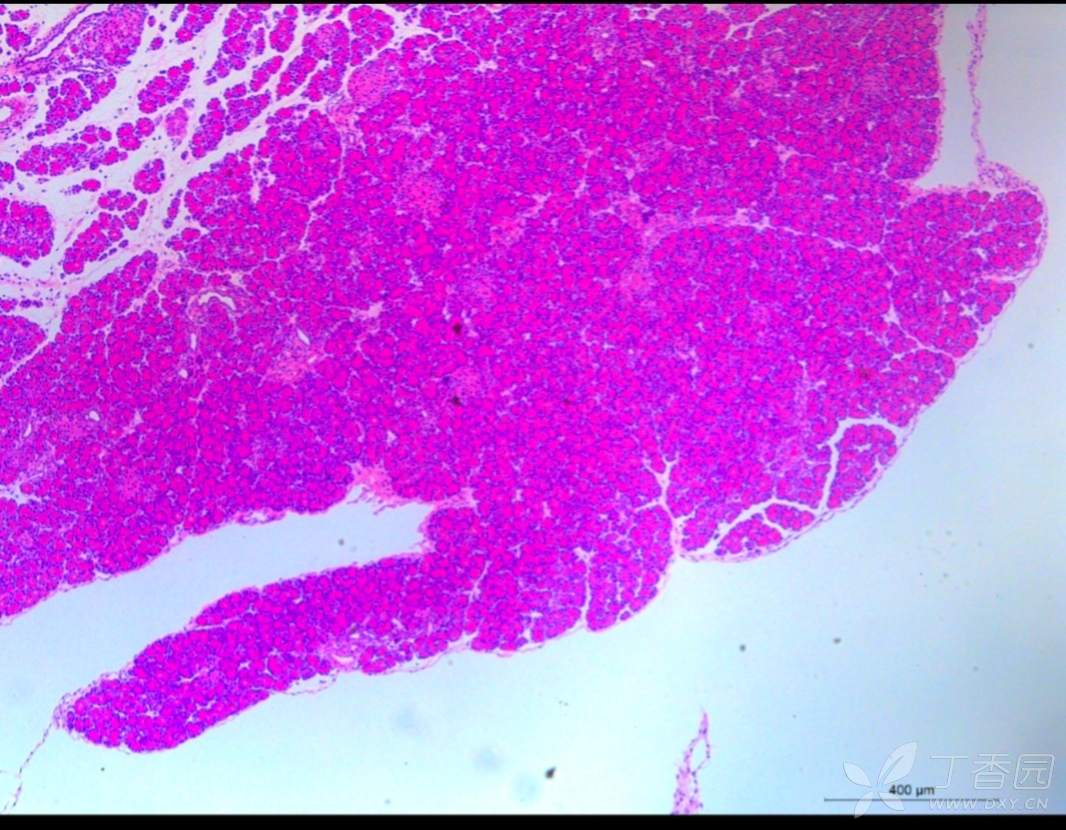 胰腺he染色分析