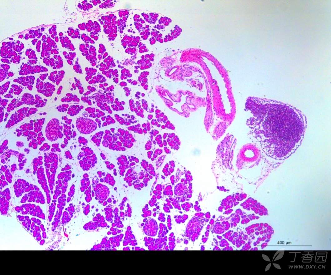 胰腺he染色分析