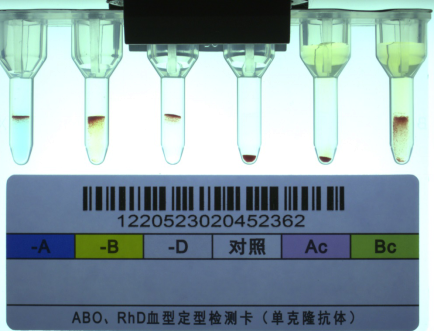 还有比「熊猫血」更稀有的血型吗？带你了解 CisAB 血型