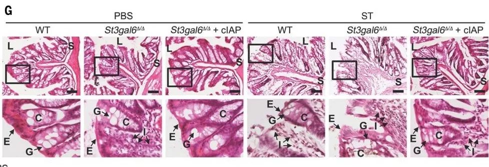 Science: 周期性的低等级细菌感染很有可能是慢性炎症疾病的诱因！