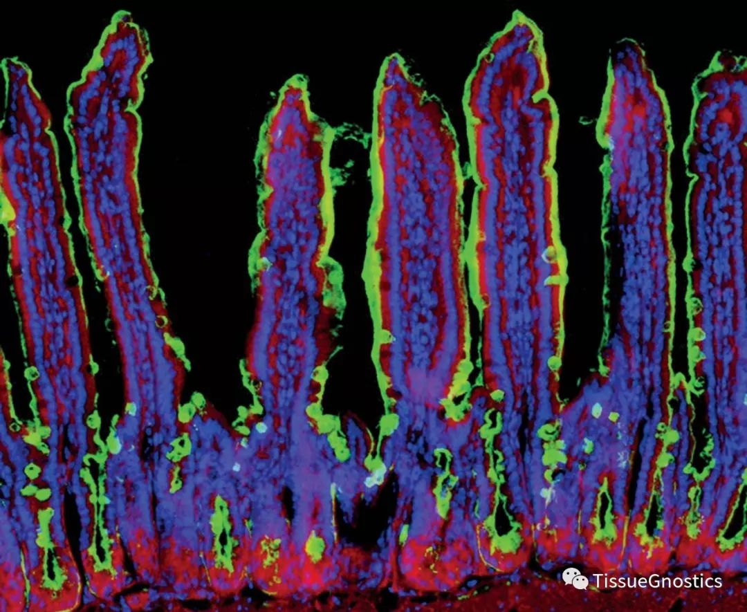 Science: 周期性的低等级细菌感染很有可能是慢性炎症疾病的诱因！
