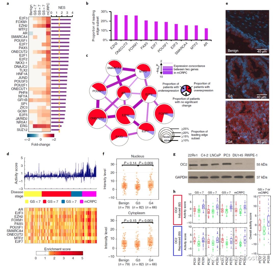 Nat Med: Onecut2或是致死性前列腺癌调节因子和治疗靶点
