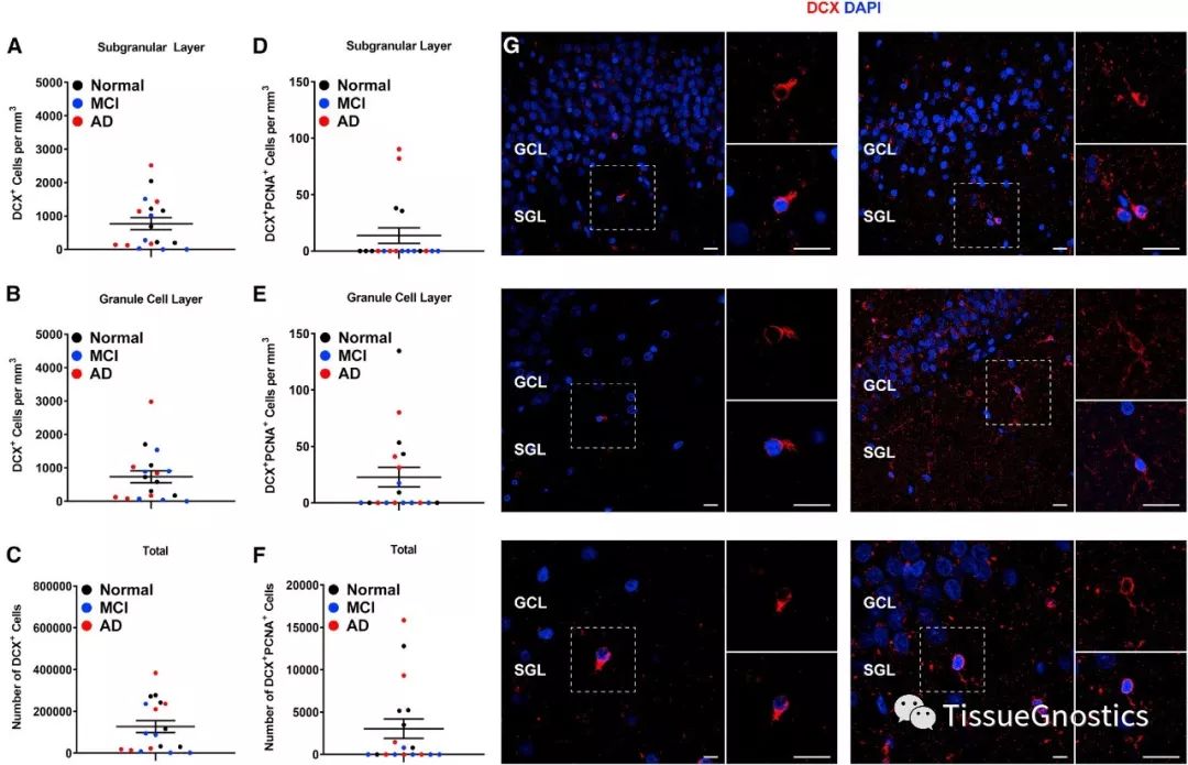 Cell子刊| 阿尔茨海默病治疗新方向？海马区神经元可以再生！