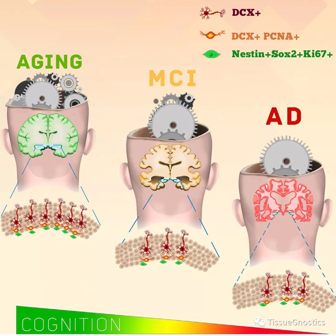 Cell子刊| 阿尔茨海默病治疗新方向？海马区神经元可以再生！