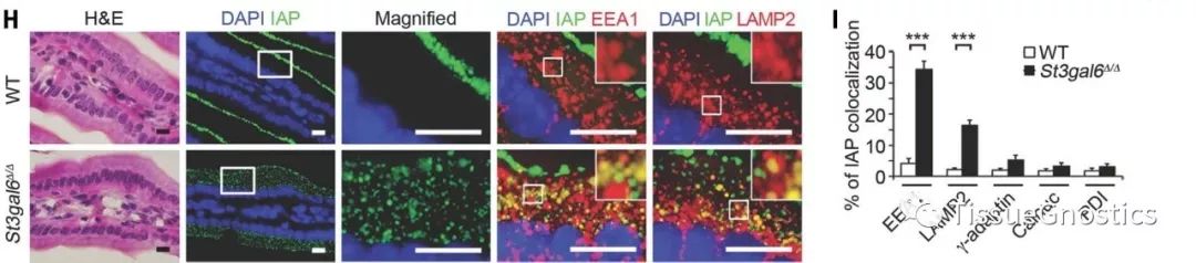 Science: 周期性的低等级细菌感染很有可能是慢性炎症疾病的诱因！