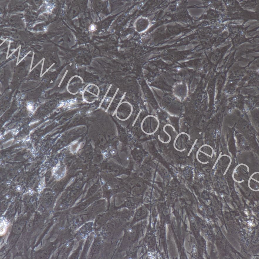 大鼠输尿管成纤维细胞/免疫荧光鉴定