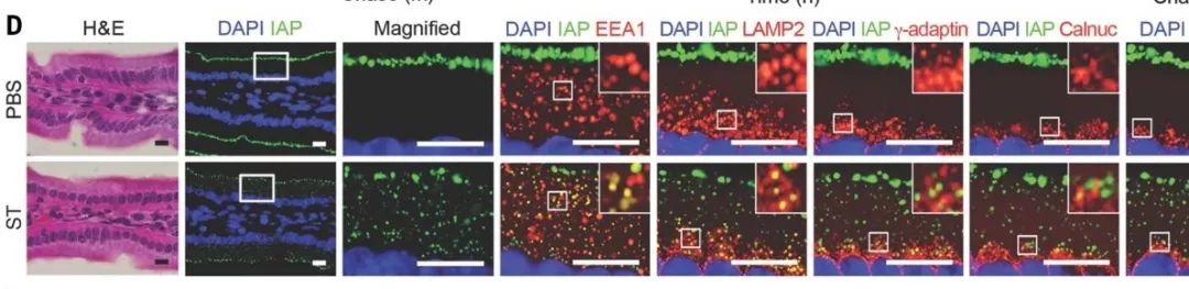 Science: 周期性的低等级细菌感染很有可能是慢性炎症疾病的诱因！