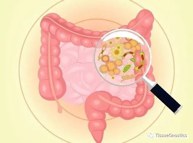 Science: 周期性的低等级细菌感染很有可能是慢性炎症疾病的诱因！