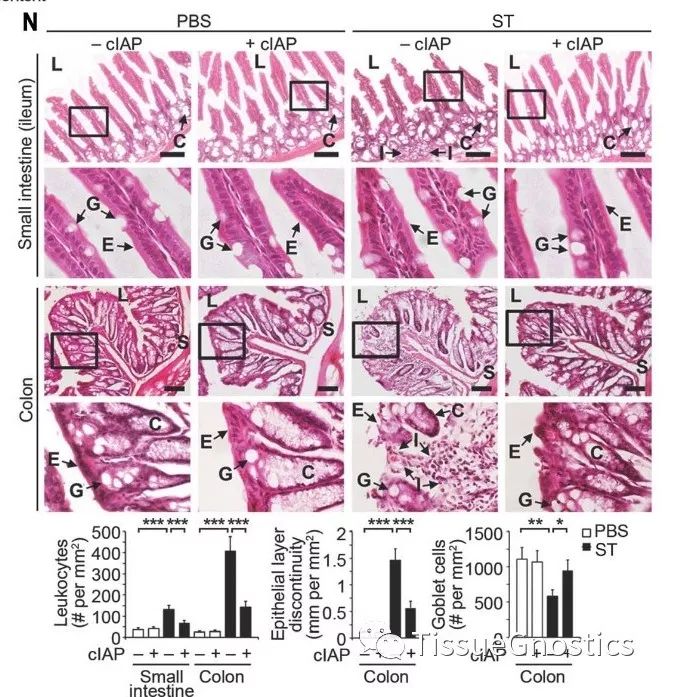 Science: 周期性的低等级细菌感染很有可能是慢性炎症疾病的诱因！