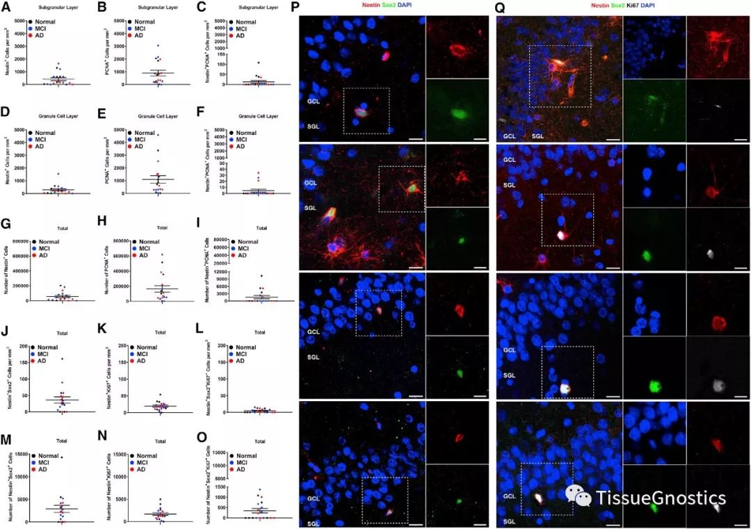Cell子刊| 阿尔茨海默病治疗新方向？海马区神经元可以再生！