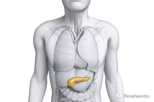 面对“癌中王”胰腺癌，我们能做些什么？