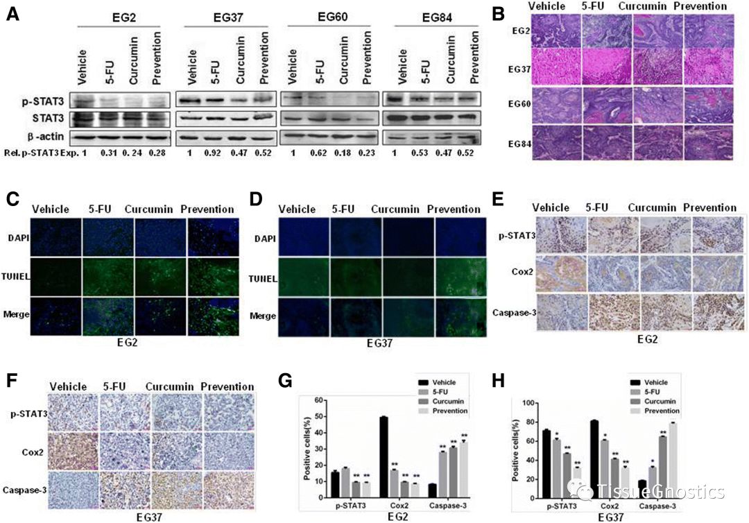 郑州大学基础医学院-天然多酚姜黄素抑制STAT 3信号转导以诱导食管鳞癌细胞的凋亡