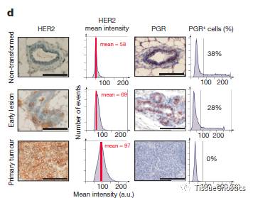 Nature丨已发现癌细胞在肿瘤出现前发生转移的原因