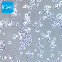 NCI-H358人非小细胞肺癌细胞/STR鉴定/镜像绮点(Cellverse)