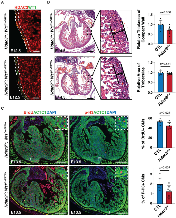 心外膜 HDAC3 通过一种新的 MicroRNA 途径促进心肌生长