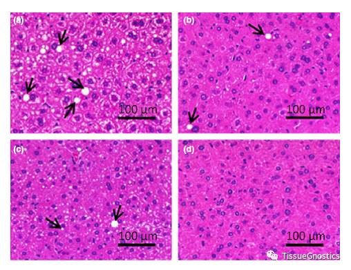 这篇讲的是脂肪细胞