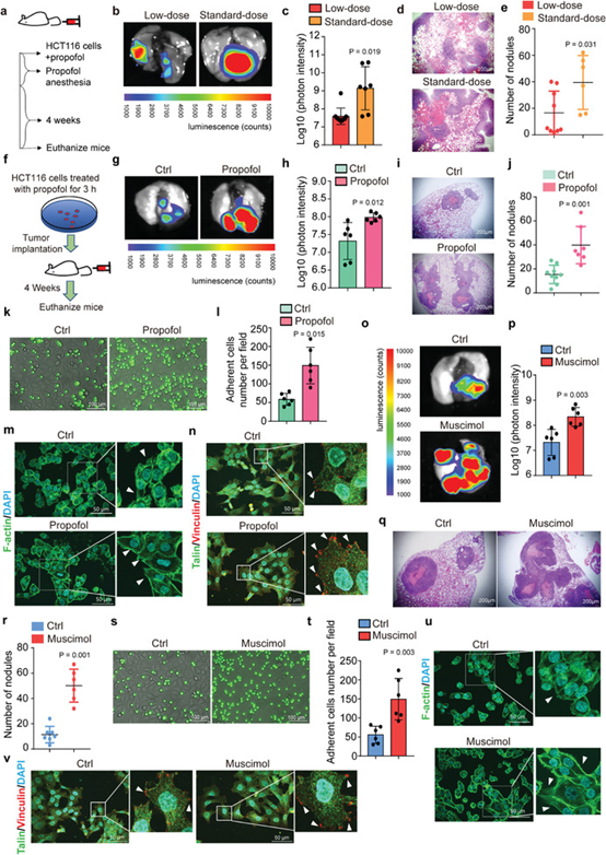 麻醉药异丙酚通过 GABAAR 依赖性 TRIM21 调节 SRC 表达促进肺肿瘤转移