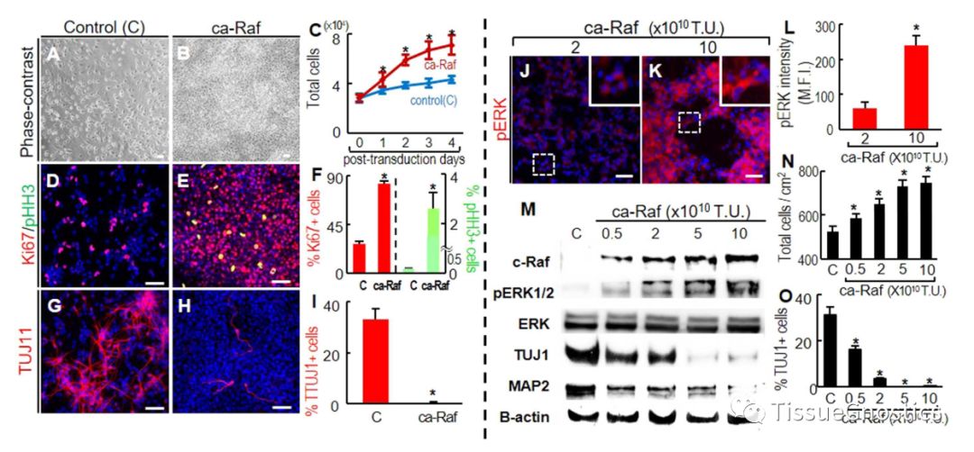 Nature| 神经干细胞分泌因子促进脑组织再生机理