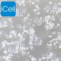 SK-BR-3 人乳腺腺癌细胞/STR鉴定/镜像绮点(Cellverse)