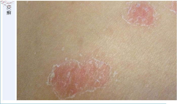 Glacial acetic acid：我的目标可不止调节pH