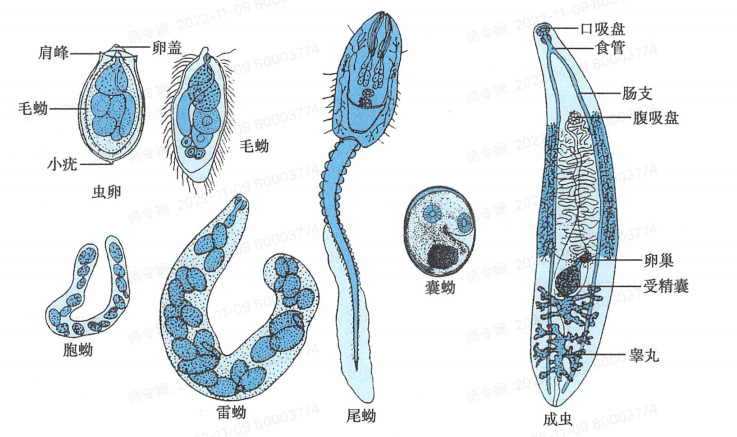 华支睾吸虫病