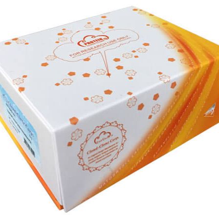 含RNA结合冷休克域蛋白E1(CSDE1)重组蛋白产品图